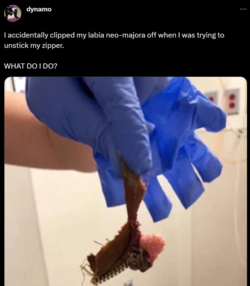 what the fuck.png