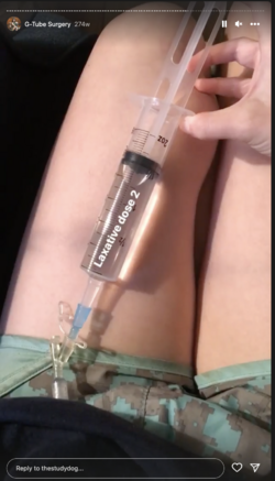 tube-050.png