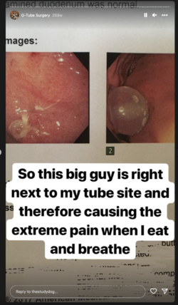 tube-077.png