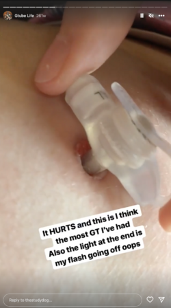 tube-084.png