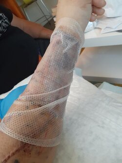 arm.jpg