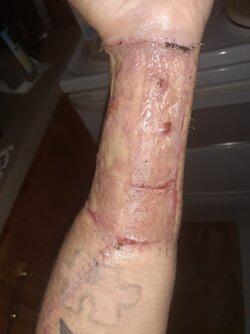 arm_4_wks.jpg