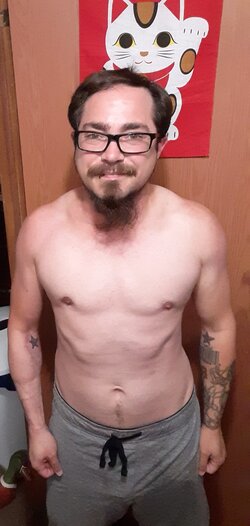 1_year_post_op_chest2.jpg