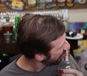 BALD.png