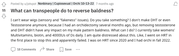 balding.png