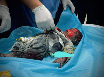 gaza 2.png