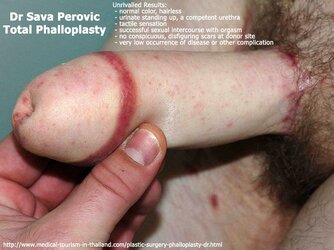neophallus-at-six-months-lg.jpg