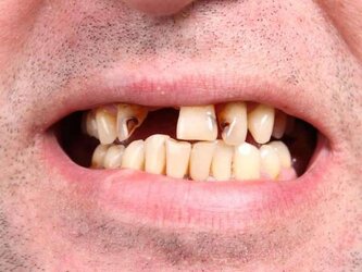 teeth.jpg