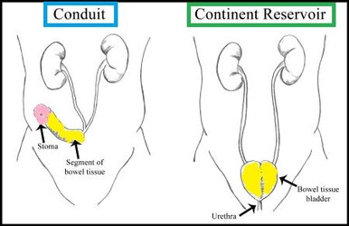 ileal[1].jpg