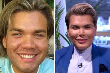 Rodrigo-Alves-before.jpg