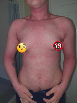 WhyArePoonersPink.jpg