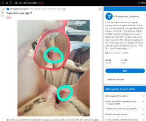 Labia_blockage3.jpg