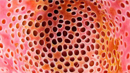 16.-Cara-Menghilangkan-Trypophobia-Sesuai-dengan-Penyebabnya-2178545152.jpg