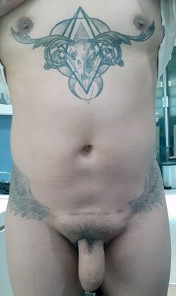 ftm-phallo-surgery-lg-min.jpg
