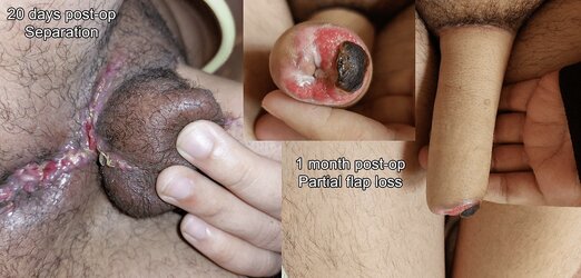 krbuurofg9cc1.jpg