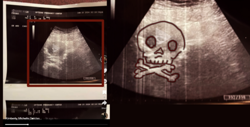 kimspoisonwomb.png