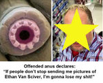 anus.jpg