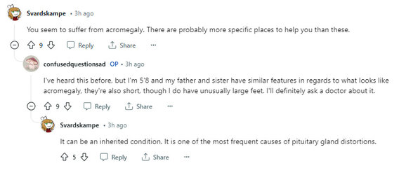Acromegaly.jpg