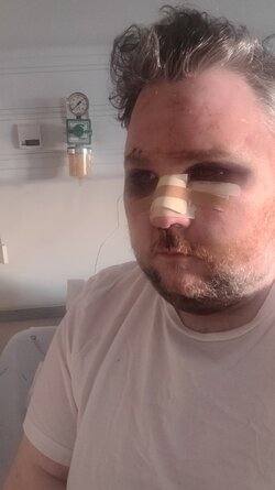 ralphpunched.jpg