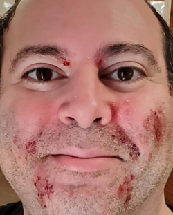 closeup.png