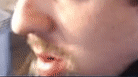 bmj_jaw.gif