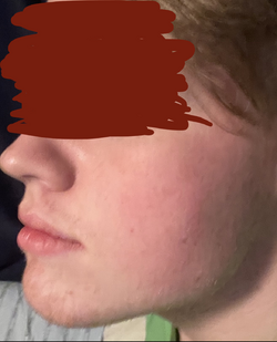 1709520639784.png