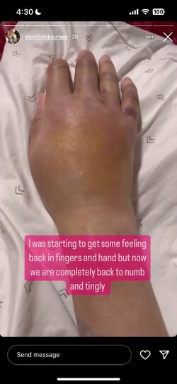 danis-hand-is-numb-and-she-has-a-busy-week-v0-gmv7mqk4kijc1.jpg