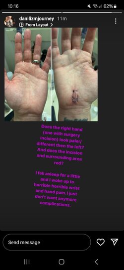 dani-doesnt-want-any-more-wrist-complications-v0-z8uok3jje1mc1.jpeg