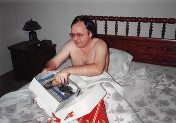 ronnie's hairline.jpg