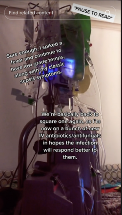 tri-572.png