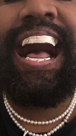 kanye-west-teeth-removed-replaced-75058406.jpg