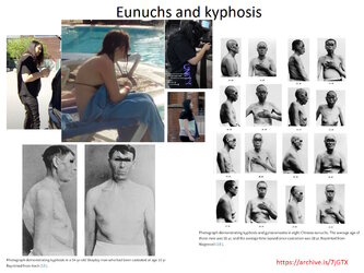 Troons Eunuchs and Kyphosis 2.jpg