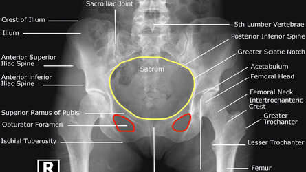 ActualFemaleHips.jpg
