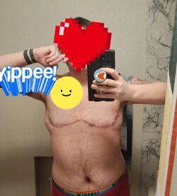 081-month-di-no-nips-with-dr-kaoutzanis-uchealth-colorado-v0-imdw0gg0mkxc1.jpg