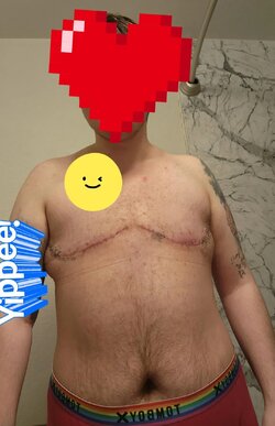 091-month-di-no-nips-with-dr-kaoutzanis-uchealth-colorado-v0-y7ogtkm0mkxc1.jpg
