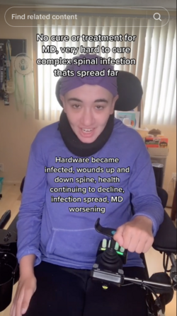 and-742.png