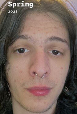before estrogen.jpg