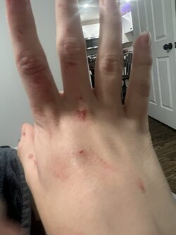BruisedFolf 2.jpg