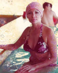 elsa-patton-before-surgery.jpeg