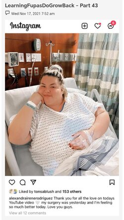 fupa_surg_01.jpeg fupa_surg_01.jpeg