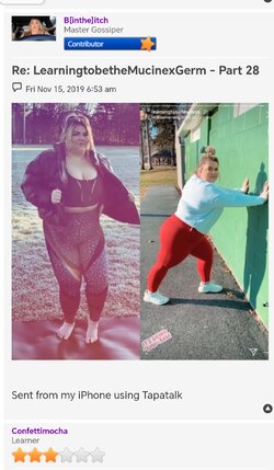 fat_surg_02.jpeg