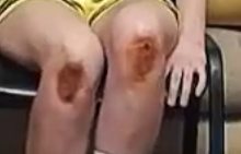 knee29.png