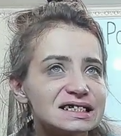 teeth.png