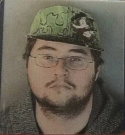 Pre Op Colton.jpg