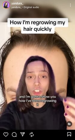Realwomenhavebaldspots.jpg