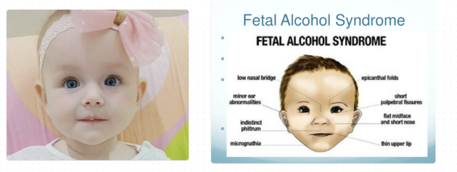 FAS.png