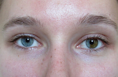 heterochromia-sectoral-hero.jpg