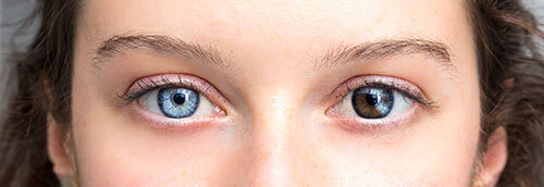 heterochromia.jpg
