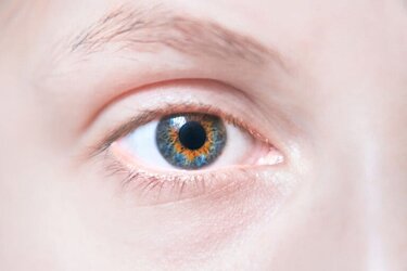 young-girl-central-heterochromia-768x512.jpg