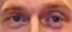eyebags.png